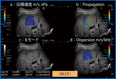 図5　Dispersion Imaging