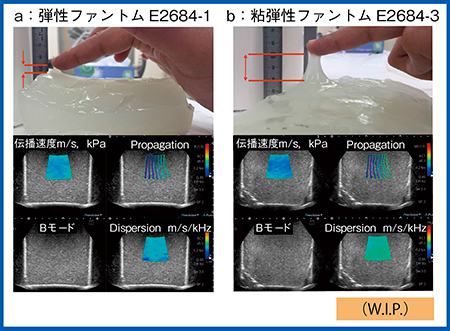 図6　弾性ファントム（a）と粘弾性ファントム（b）のDispersion Imaging