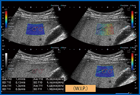 図8　脂肪肝のDispersion Imaging