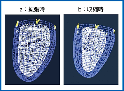 図1　3D-WMTの拡張時（a）と収縮時（b）の画像