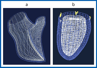 図3　3D RV Speckle tracking（a）と‌3D LV Speckle tracking（b）の画像対比