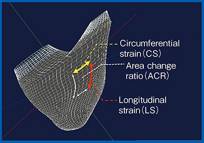 図5　右室の3Dストレイン指標の計測