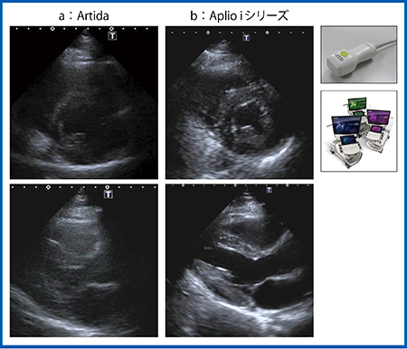 図8　Artida（a）とAplio iシリーズ（b）の画像比較