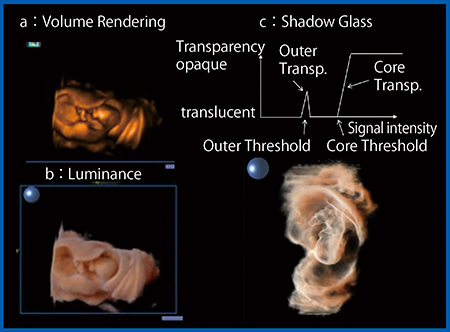 図10　新表示法Shadow Glassによる胎児の描出