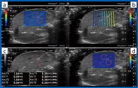 図3　Shear Wave ElastographyによるDispersion Imagingの実際の画面