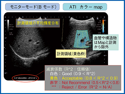 図4　ATIの計測画面