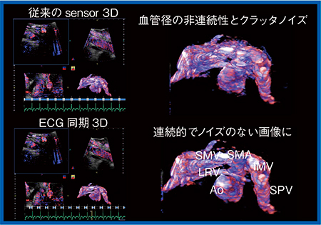 図9　心電同期3D（ECG-synchronized US：ESUS，仮称）