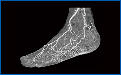 図7　Aquilion Precisionによる足部動脈の描出