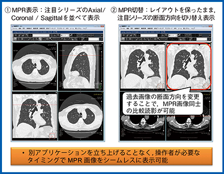 図4　2種類のMPR機能