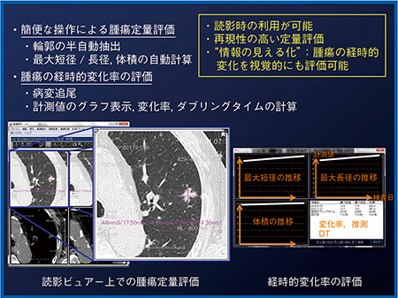 図6　腫瘍計測アプリケーション