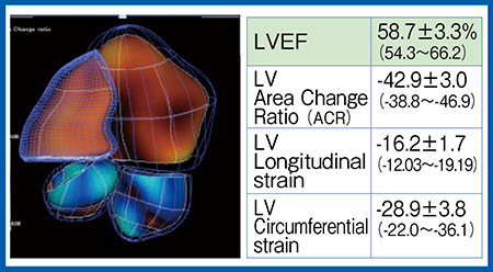 図2　健常25例における3D-WMTによる左室機能評価