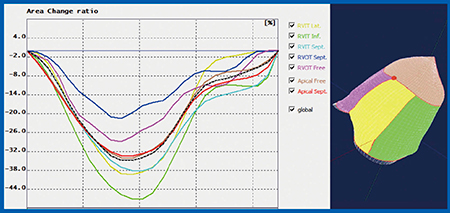 図6　右室の7分画のストレインの計測