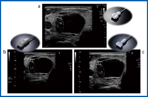 図2　超音波診断装置の進化：Bモード（12MHz） a：Aplio i800　b：Aplio XG　c：Aplio 500