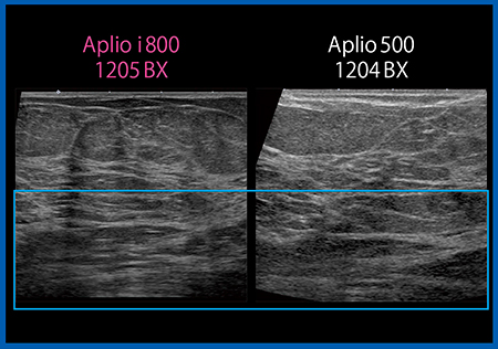 図1　超広帯域高周波リニアプローブPLI-1205BX（左）と従来プローブ（右）の画像比較