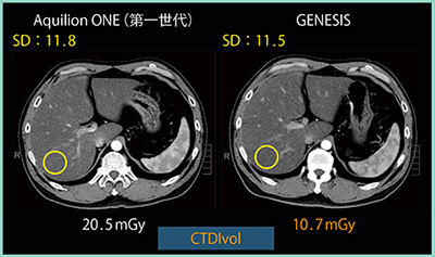 図1　Aquilion ONEとGENESISにおけるSD値とCTDIvolの比較