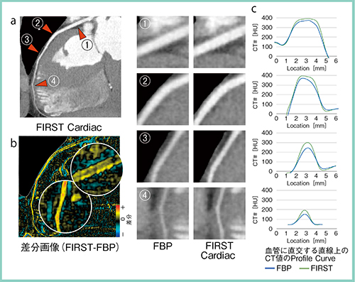 図3　冠動脈の描出能の向上