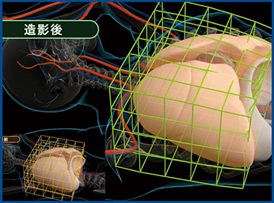 図7　非線形位置合わせのイメージ