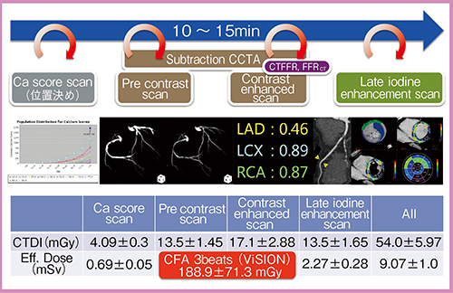 図5　ワンストップ心臓CTのプロトコール
