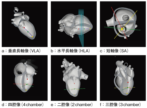 図2　左心室画像診断の基準となる6断面 VLA：vertical long axis　HLA：horizontal long axis　SA：short axis