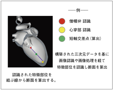 図3　特徴部位認識技術