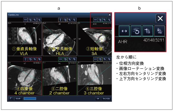 図4　CardioLine設定画面