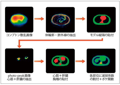 図2　SSPAC法による減弱補正マップ作成の概念図