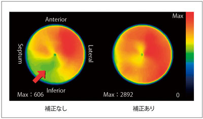 図3　201Tl正常例におけるSSPAC法の効果 （データご提供：藤田保健衛生大学様，三重大学様）