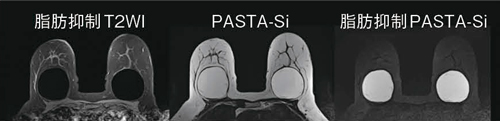 図2　PASTA-Si