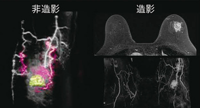 図3　Time-SLIP法（画像ご提供：住友別子病院様）