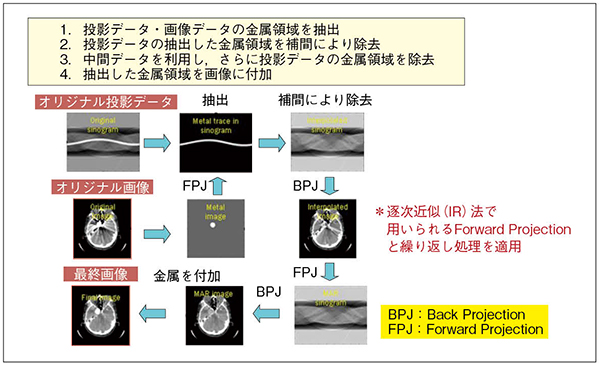 図2　SEMAR（Single Energy Metal Artifact Reduction