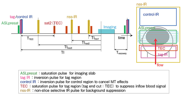 図1　3D-ASTAR ASL pulse sequence