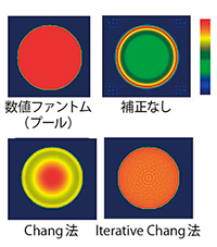 図7　減弱補正の効果