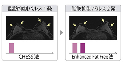 図2　脂肪抑制法の比較