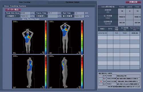 図1　DoseRite DTS線量管理レポート