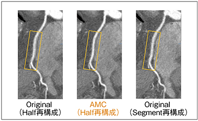 図2　AMC：臨床画像