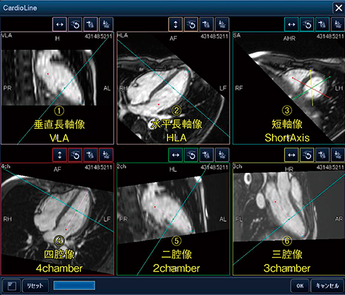 図1　CardioLineの操作画面