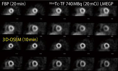 図5　3D-OSEMによる空間分解能・コントラストの向上