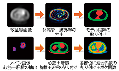 図7　SSPAC法による減弱マップ作成