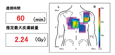 図7　DICOM RDSRによる線量管理レポート