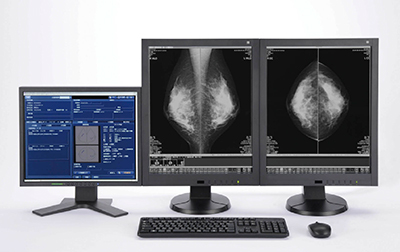 図1　東芝製マンモビューア
