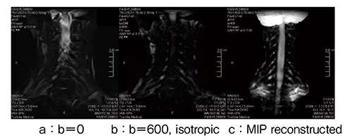 図4　FASE-DWI頸部画像