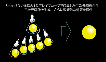 図1　Smart 3Dの画像収集と三次元画像の構築