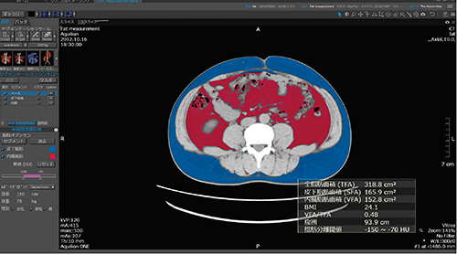 図2　体脂肪面積計測解析画面