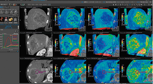 図5　ボディパーフュージョン解析画面2
