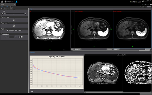 図2　MR IVIM解析画面