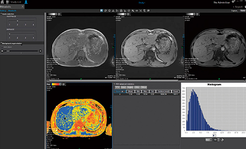図4　MR Metabolic解析画面