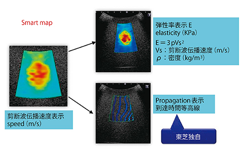 図2　Shear Wave Elastography：3つの表示モード