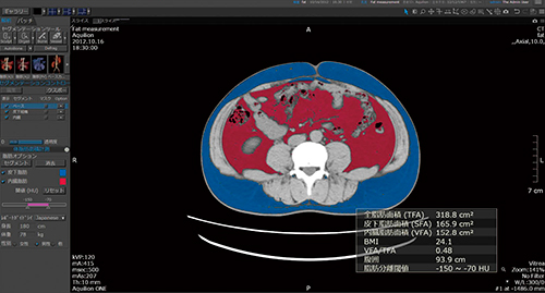 図2　体脂肪面積計測解析画面