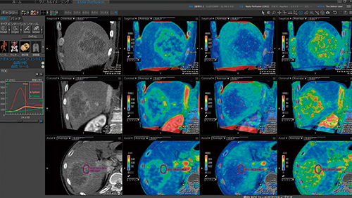 図3　ボディパーフュージョン解析画面