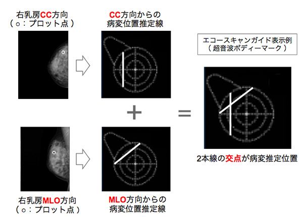 図1　マンモグラフィ画像上のプロット例